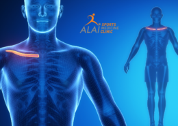 Recuperación Athenea fractura clavícula