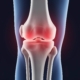 Especialista lesión rodilla