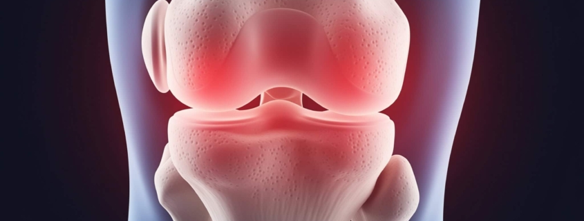 Especialista lesión rodilla