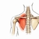 Rotura del tendon supraespinoso